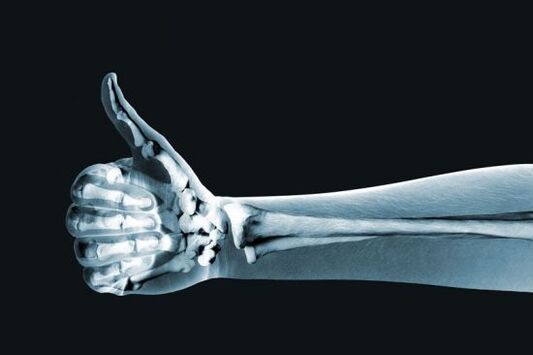 Radiografía para diagnosticar el dolor en las articulaciones de los dedos. 