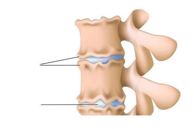 lesión espinal